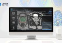 Poznaj Radiology Platform – narzędzie do porównania analizy z diagnozą patomorfologiczną w leczeniu raka