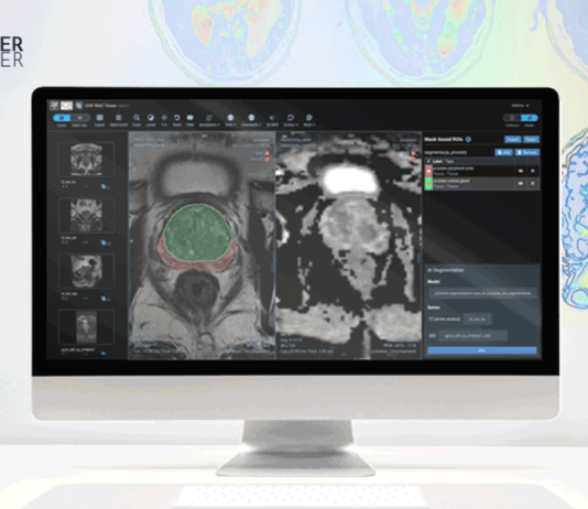 Poznaj Radiology Platform – narzędzie do porównania analizy z diagnozą patomorfologiczną w leczeniu raka