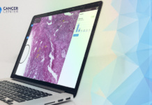 Poznaj PathoPlatform – innowacyjną przeglądarkę slajdów histopatologicznych