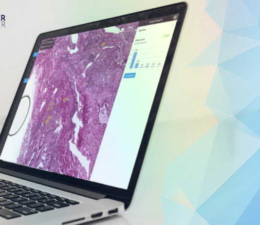 Poznaj PathoPlatform – innowacyjną przeglądarkę slajdów histopatologicznych