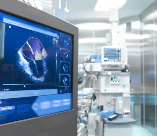 USG zdalnie? – tak! Poznaj system MELODY!