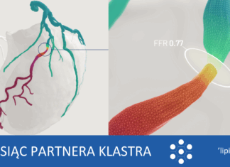 Od frustracji do innowacji. Historia polskiej technologii, która może zmienić świat diagnostyki serca