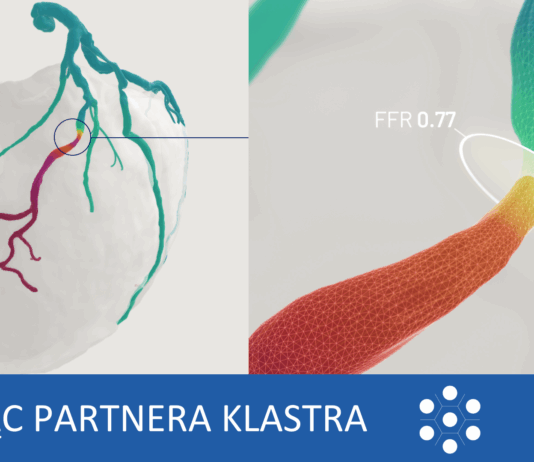 Od frustracji do innowacji. Historia polskiej technologii, która może zmienić świat diagnostyki serca