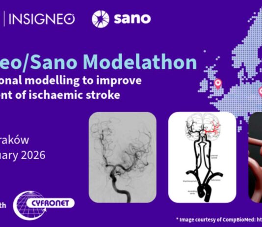 Dołącz do Modelathonu 2026 – wspólnie modelujmy udar niedokrwienny!